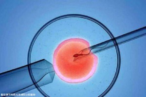 爱心同性供卵咨询怎么收费